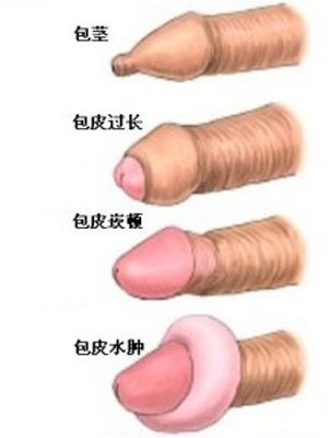 �����п�ҽԺ��Щ�����ã���������ҽԺ�������п�