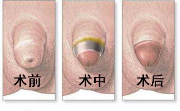 ���Ÿ��Ƥ�ļҺ÷��ã���������ҽԺ�������п�