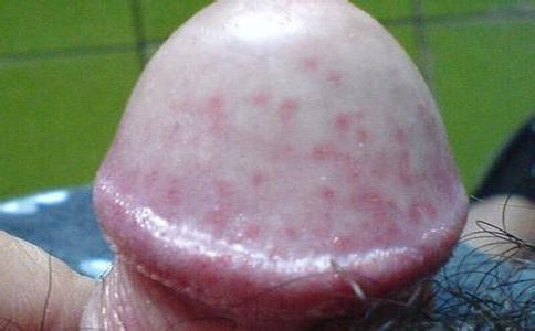 ��ͷ��Ƥ����ô�Σ���������ҽԺ�������п�