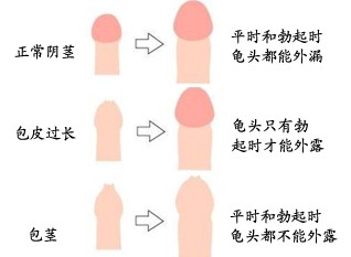 ���Ÿ��Ƥ�������ô���Ƕ��٣���������ҽԺ�������п�